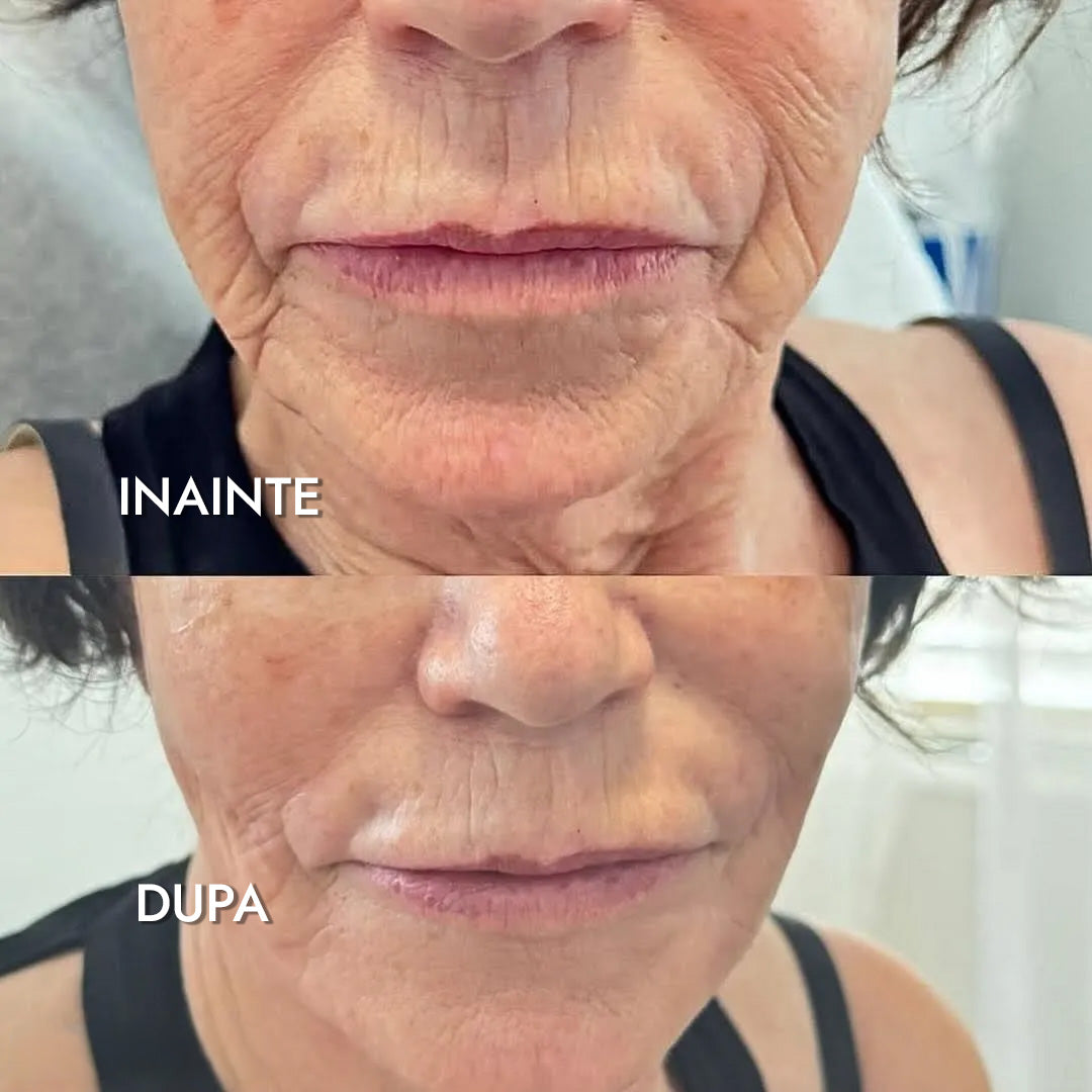 Balsam Corean Antirid cu PDRN si Colagen
